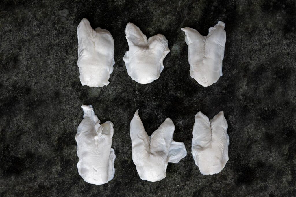 10. Kokotxas